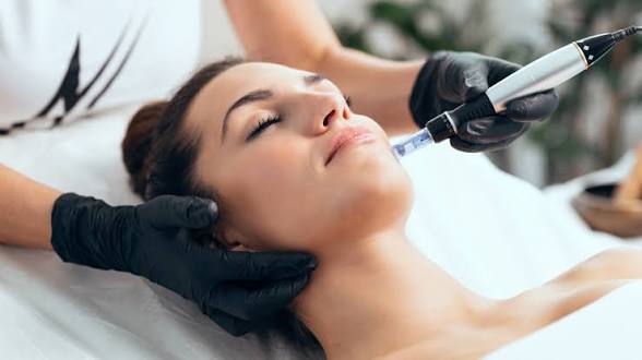 Micro needling: What is it, How it works, and why you should consider it.