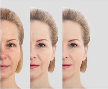 What Happens to Your Face After Weight Loss?